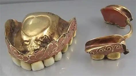 Are Old Dentures Worth Anything
