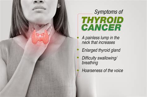are symptoms always a sign of thyroid cancer