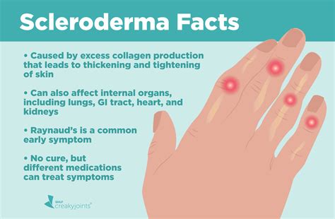 are symptoms scleroderma