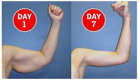 Arm Fat Reduction Treatment Reduce And Gain Upper Exercise 7 Days Challenge