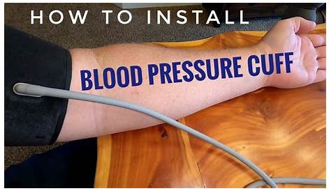 Arm Too Fat For Blood Pressure Cuff Different In Right And Left