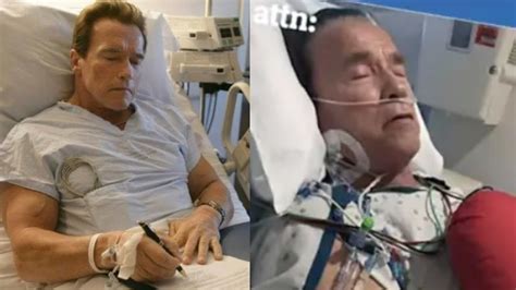 arnold schwarzenegger mild stroke