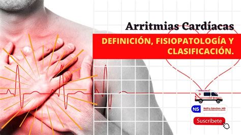 arritmia definicion