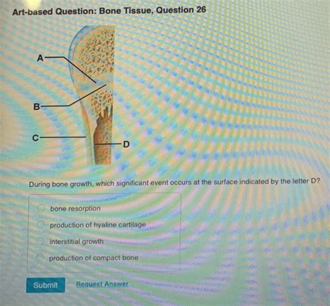 Art-Based Question Bone Tissue Question 21