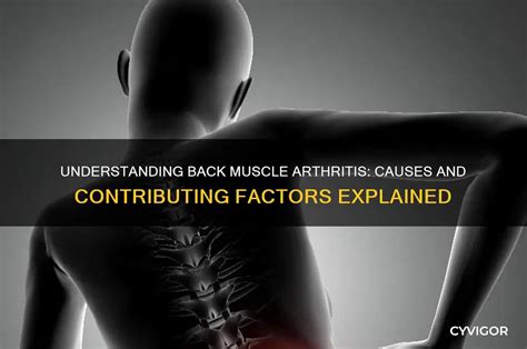 Arthritis In Back Causes