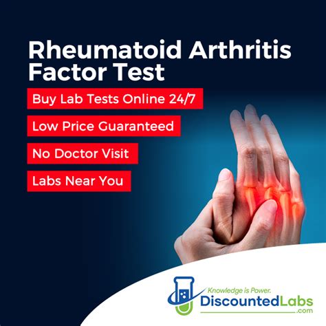 Arthritis Labs
