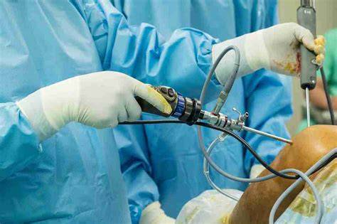 Arthroscopic