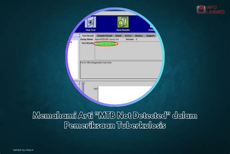 arti mtb detected medium