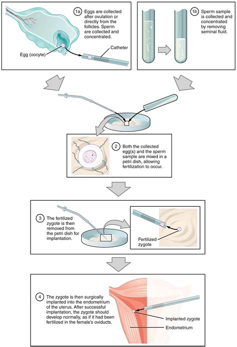 article on in vitro fertilization