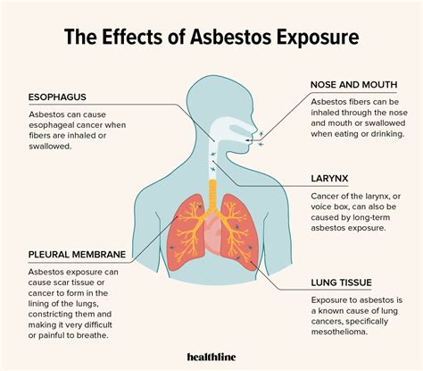 asbestos and lung cancers