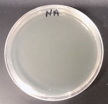 How To Spell Aseptic (And How To Misspell It Too)