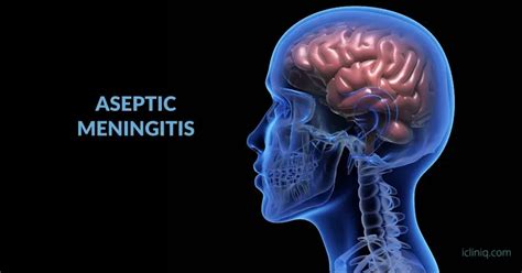 aseptic meningitis caused by