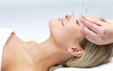 ash acupuncture