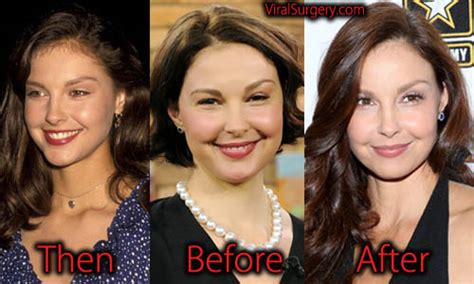 ashley judd before and after face work