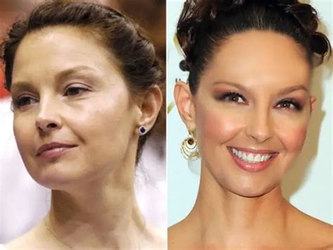 ashley judd facelift from hell