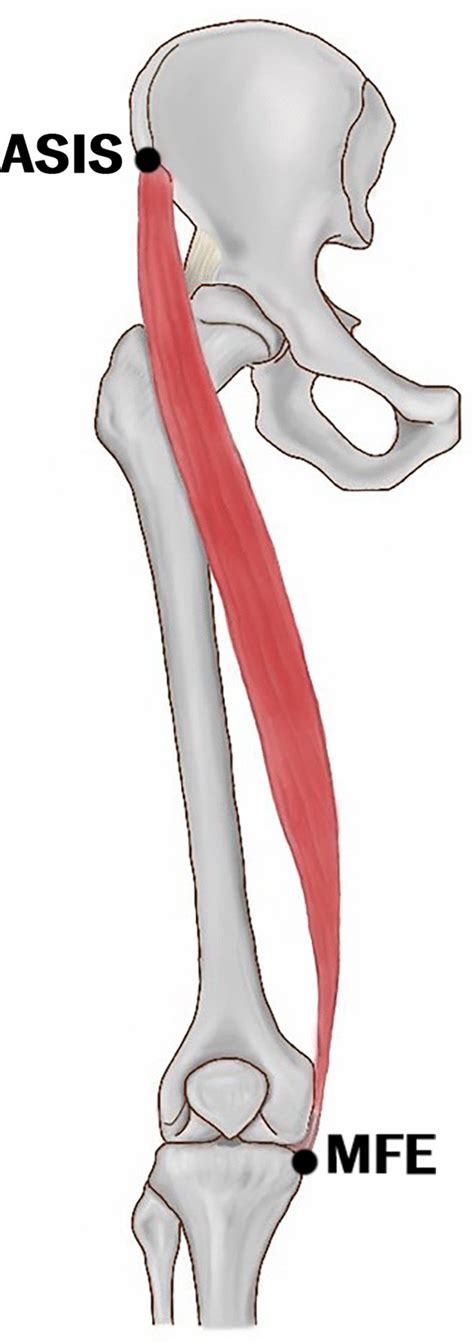 asis attachment of muscles