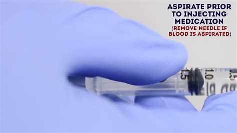 Aspirate Injection Definition