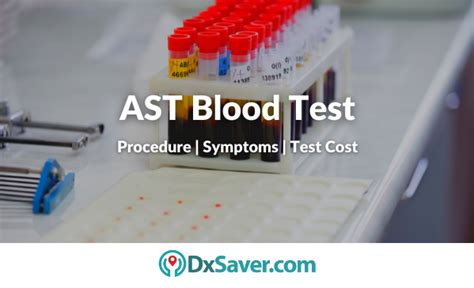 What Does an AST Lab Test High Result Indicate?