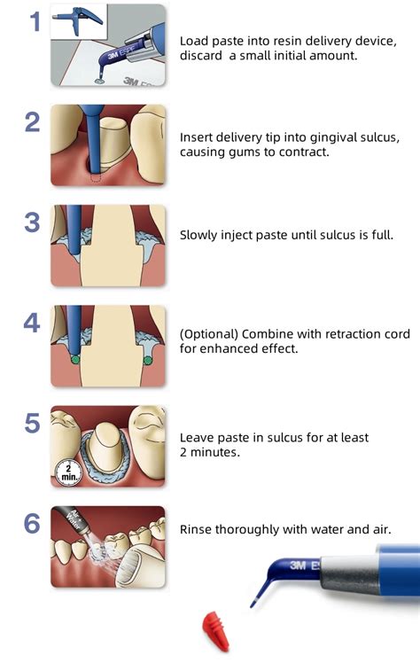 Astringent Retraction Paste Instructions
