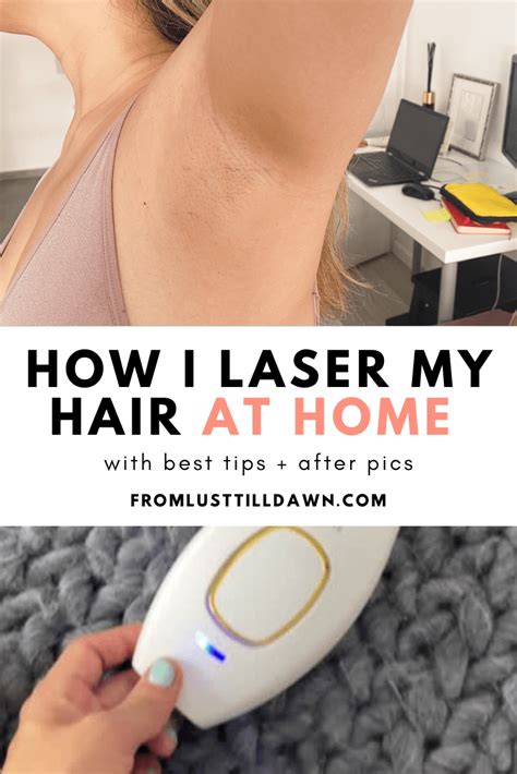 at home laser hair removal reddit