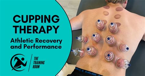 Athletic Cupping Benefits