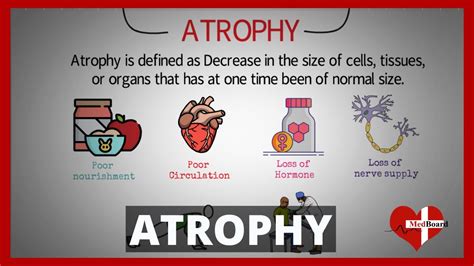 atrophy medical definition and causes