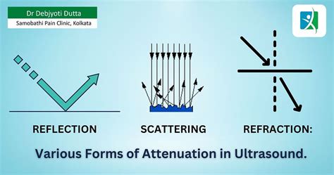 Attenuation Scattering Example