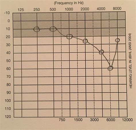 audiogram procedure code