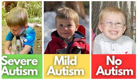 Autism Quiz What Does Mild Mean Signs Of Severe No Compared YouTube