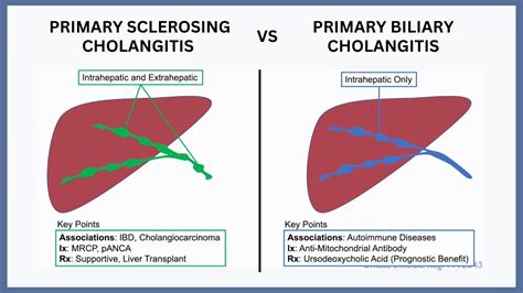 autoimmune cholangitis vs primary sclerosing cholangitis