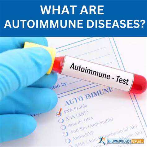 Unlock the Mystery: Can an Autoimmune Disease Test Provide Answers?