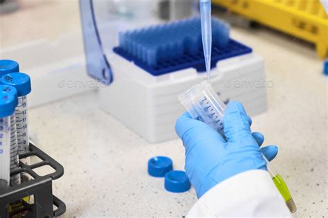 Automatic Pipette Procedure