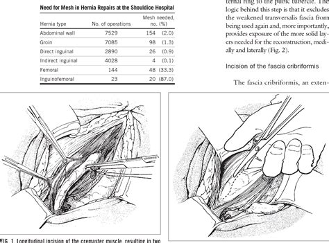 average cost of inguinal hernia surgery