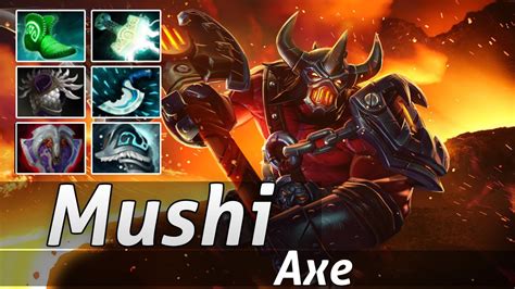 axe build dota 2