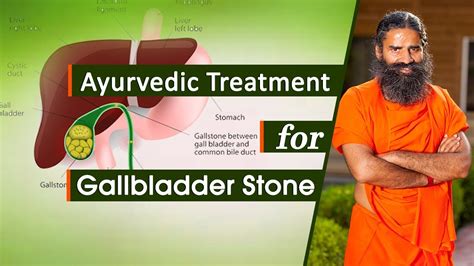 Ayurveda Medicine For Gallbladder