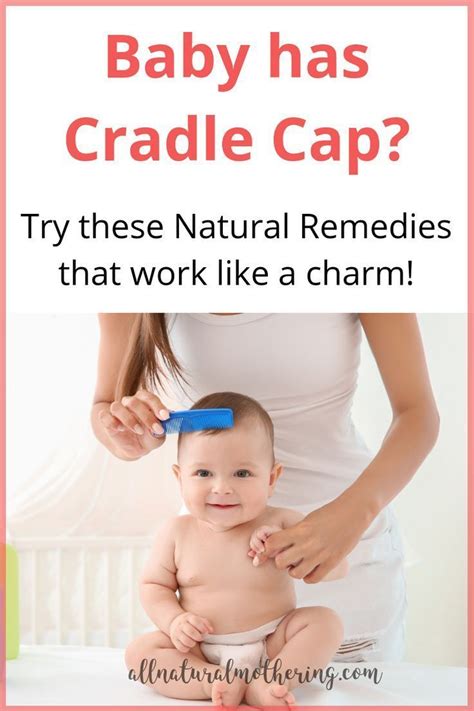 home.furnitureanddecorny.com:ayurvedic treatment for cradle cap in babies
