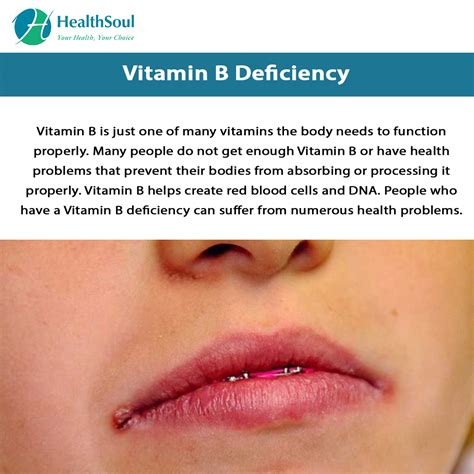 Uncovering the Hidden Dangers of B Vitamin Deficiency: What You Need to Know
