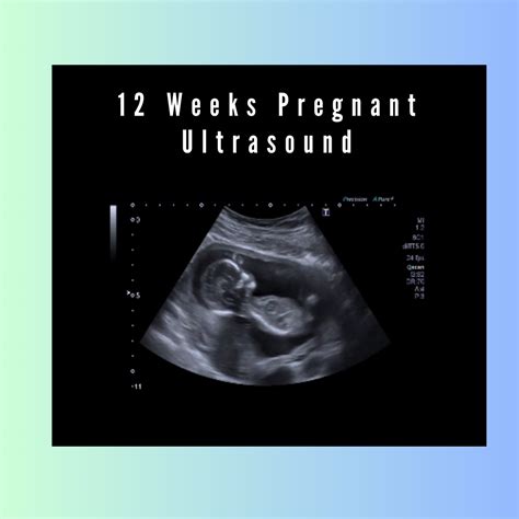 What to Expect with Babies at 12 Weeks Old