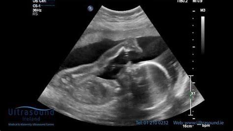 What to Expect: Baby Development at 20 Weeks Pregnancy Milestones