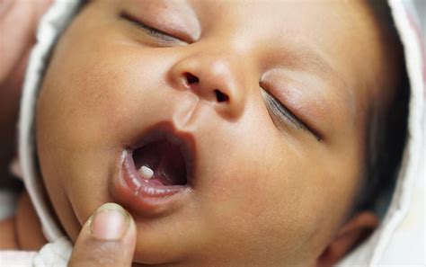 Babies Born With Teeth
