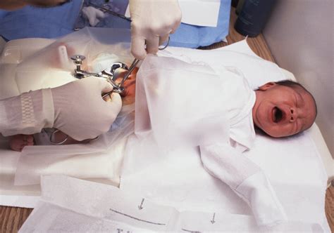 Baby Sleepy After Circumcision