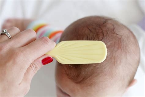 baby dry scalp losing hair