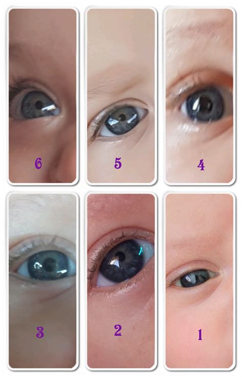 Baby's Eye Development Stages