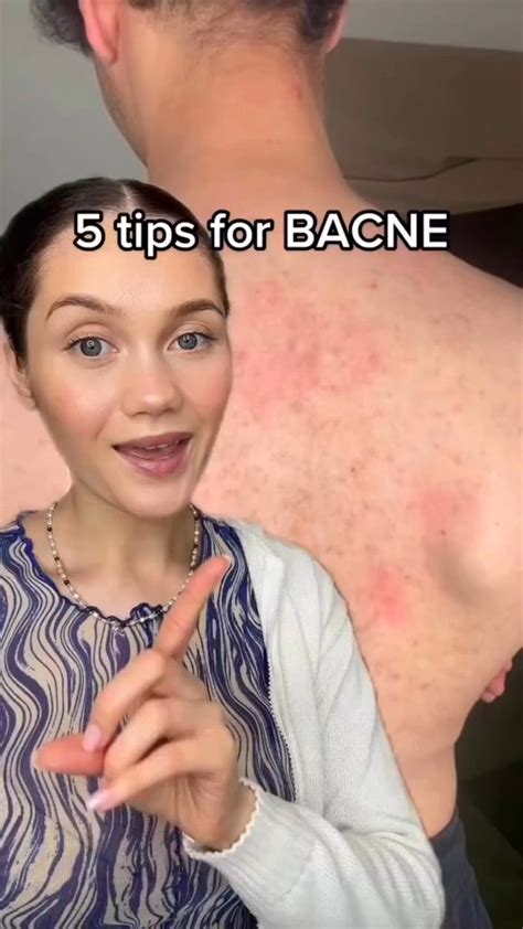 Back Acne Routine