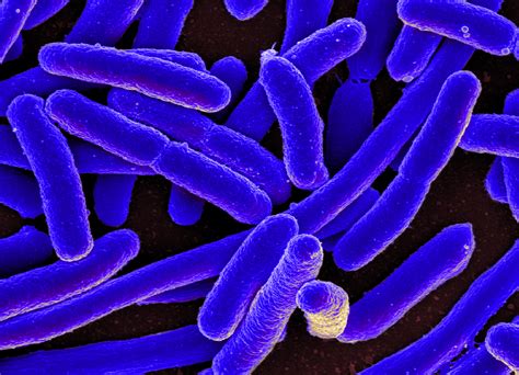 bacteria escherichia coli wikipedia