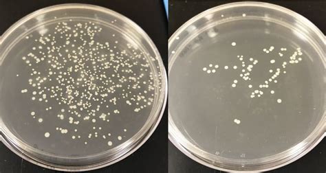 bacteria growth on agar plates