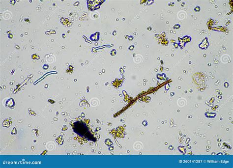 Bacteria in the Soil Microscope