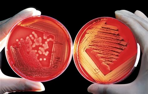 bacteria on blood agar