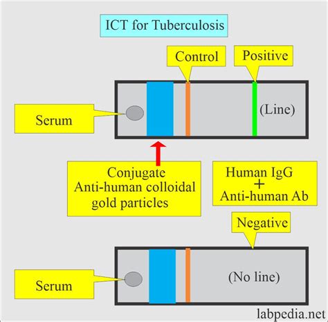 Bacteriological Test For Tb Detection