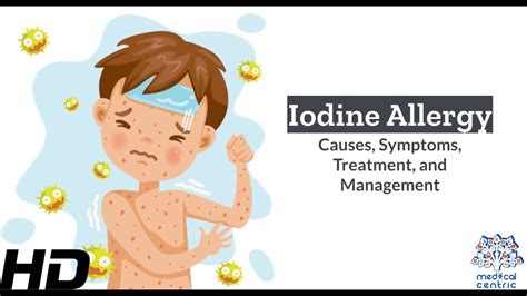 bactrim and iodine allergy